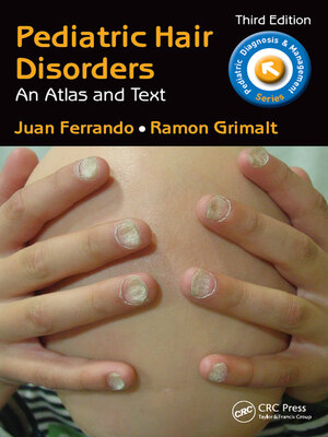 cover image of Pediatric Hair Disorders